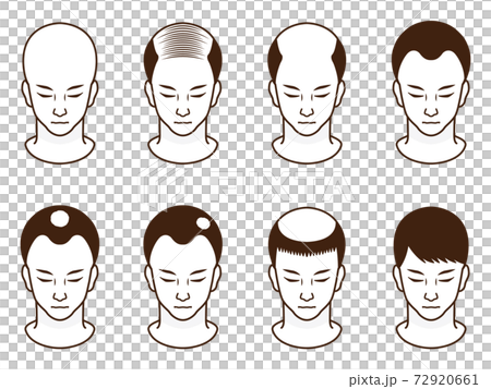 ハゲ頭の男性のアイコンイラスト素材セット5のイラスト素材