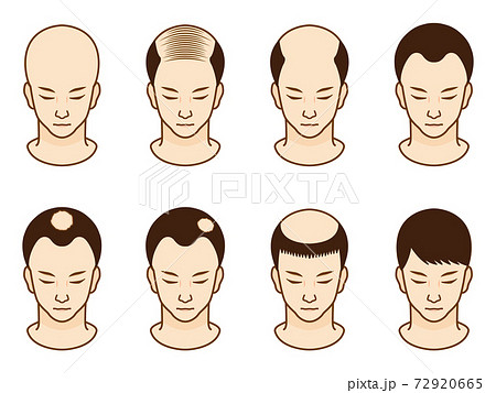 ハゲ頭の男性のアイコンイラスト素材セット2のイラスト素材