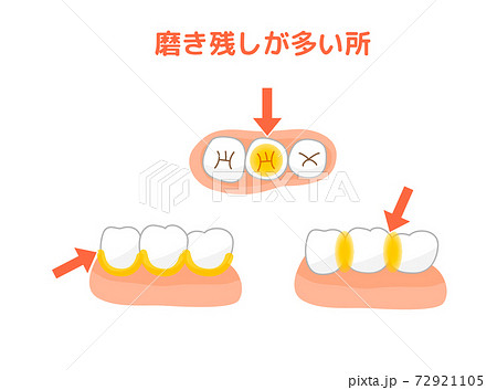 タフトブラシ歯磨き 食べ残し タフトブラシ歯磨き 食べ残し 72921105