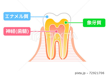 歯の構造図：歯科イラスト 72921706