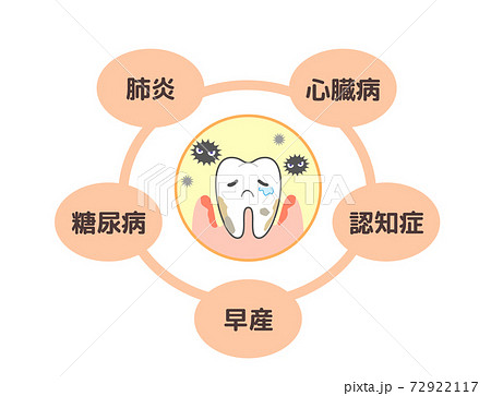 歯周病が引き起こす様々な病気:肺炎糖尿病など 歯周病が引き起こす様々な病気:肺炎糖尿病など 72922117