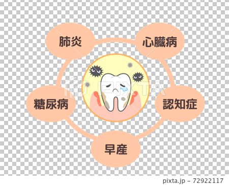 牙周疾病引起的各種疾病:肺炎,糖尿病等 牙周疾病引起的各種疾病:肺炎,糖尿病等 72922117