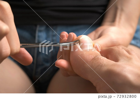 Woman is cutting man's nails on toes using scissors, closeup hands view. 72932800