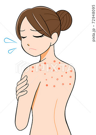 背中にきび 悩む女性 イラストのイラスト素材