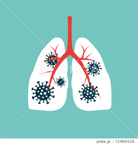 Virus cells eating lung. Virus cells biting lung. Damaged lung. Virus cell with scary and evil face. Coronavirus eating lung concept. COVID-19. 2019-nCoV. 72960526