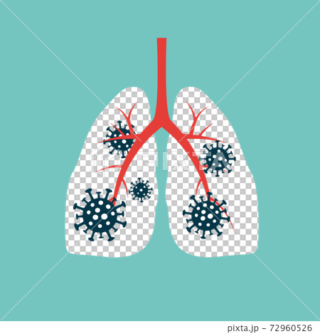 Virus cells eating lung. Virus cells biting lung. Damaged lung. Virus cell with scary and evil face. Coronavirus eating lung concept. COVID-19. 2019-nCoV. 72960526