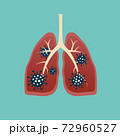 Virus cells eating lung. Virus cells biting lung. Damaged lung. Virus cell with scary and evil face. Coronavirus eating lung concept. COVID-19. 2019-nCoV. 72960527