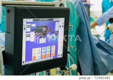 Cardiopulmonary bypass monitor, artificial blood circulation apparatus in the intensive care unit 72992485