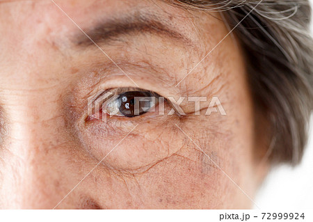 シニア女性 目元イメージ シニア女性 目元イメージ 72999924