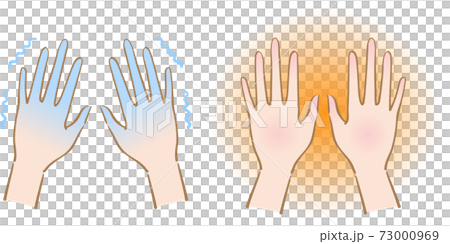 手の冷え 温める ビフォアアフター 手の冷え 温める ビフォアアフター 73000969