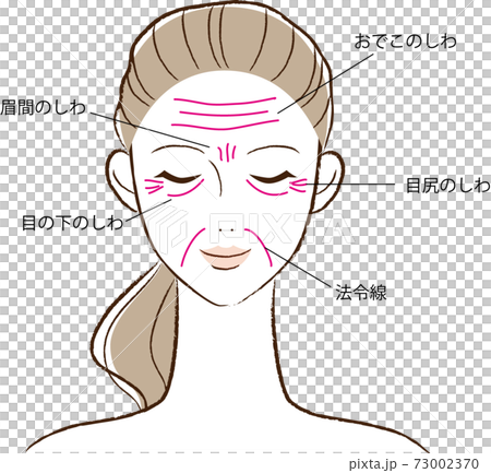 主要皺紋的類型 73002370