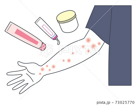 アトピー・虫刺され・湿疹ができた腕を薬で治療するイラスト 73025770