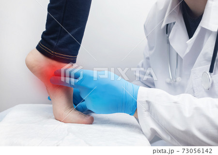 An orthopedic surgeon examines a woman's leg. Foot pain, tendon sprains, inflammation, flat feet, bursitis, fasciitis. Foot disease treatment concept. The doctor examines An orthopedic surgeon examines a woman's leg. Foot pain, tendon sprains, inflammation, flat feet, bursitis, fasciitis. Foot disease treatment concept. The doctor examines 73056142