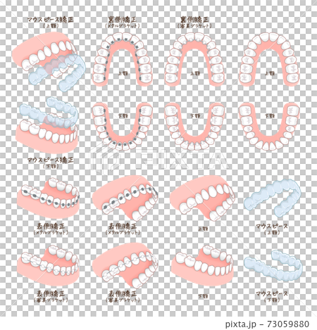 正畸設備的插圖 73059880