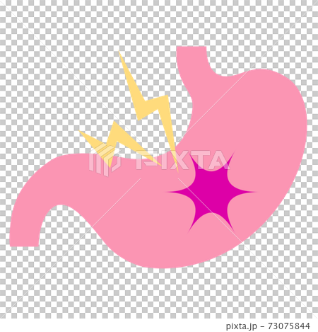 Stomach pain Stomach pain 73075844