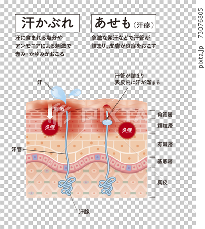 Cross section of the skin 31 front 73076805