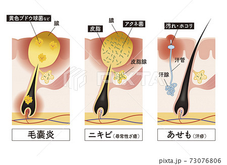 Cross section of the skin 30 front 73076806