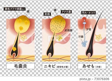 Cross section of the skin 30 front 73076806