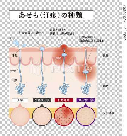 skin, skinned, vector 73076807