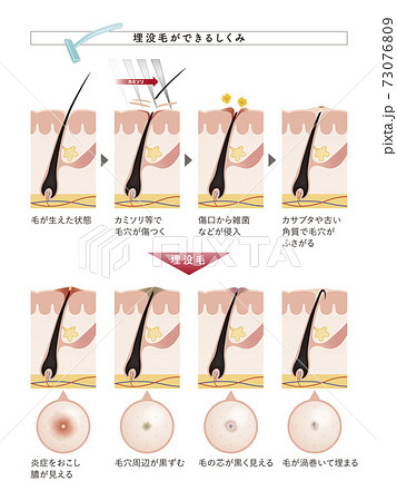 Cross section of the skin 27 front 73076809