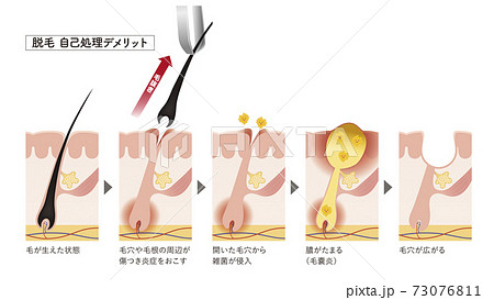 Cross section of the skin 26 front Cross section of the skin 26 front 73076811