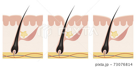 Cross section of the skin 13 front No commentary Cross section of the skin 13 front No commentary 73076814