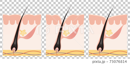 Cross section of the skin 13 front No commentary Cross section of the skin 13 front No commentary 73076814
