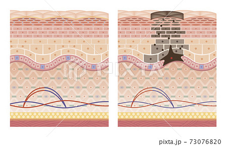 Cross section of the skin 9 front No commentary Cross section of the skin 9 front No commentary 73076820