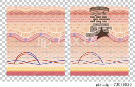 Cross section of the skin 9 front No commentary Cross section of the skin 9 front No commentary 73076820