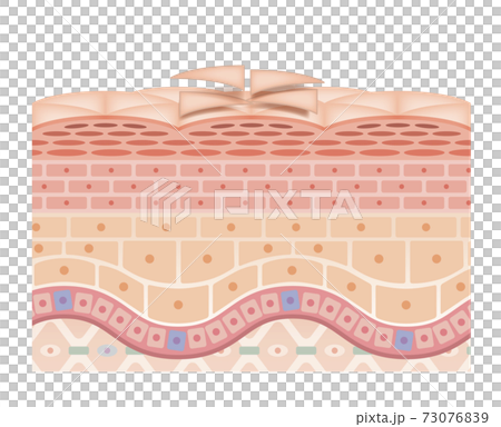 skin, skinned, cross-section diagram 73076839