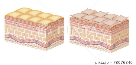 Cross section of the skin 5 No commentary Cross section of the skin 5 No commentary 73076840