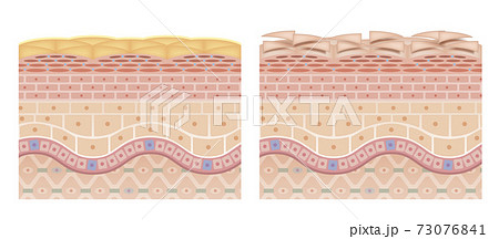 Cross section of the skin 5 front No commentary Cross section of the skin 5 front No commentary 73076841