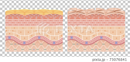 skin, skinned, cross-section diagram 73076841