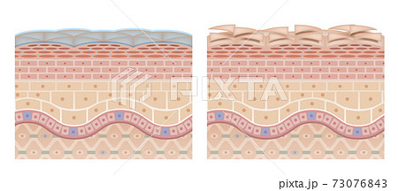 Cross section of the skin 4 front No commentary 73076843