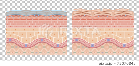 Cross section of the skin 4 front No commentary 73076843