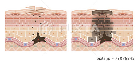 Cross section of the skin 2 front No commentary 73076845