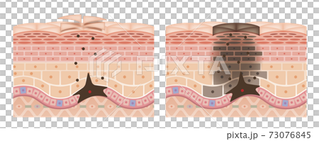 Cross section of the skin 2 front No commentary 73076845