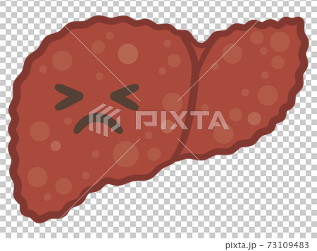 肝硬化的痛苦表情插圖 73109483