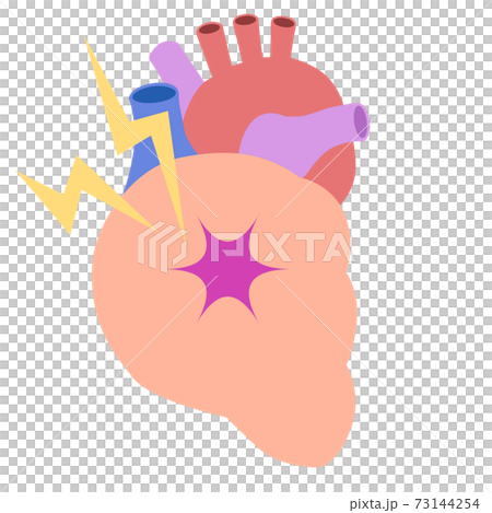 臓器_心臓の痛み 73144254