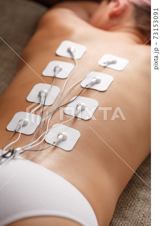Myostimulation electrodes on a woman's back for massage and rehabilitation. 73153091