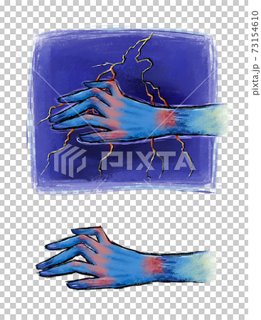 Finger disease and health care 73154610