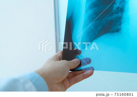 医療イメージ 医療イメージ 73160801