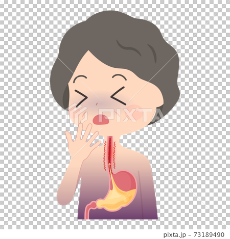逆流性食道炎で苦しむおばあちゃんのイラスト_胃の断面 73189490
