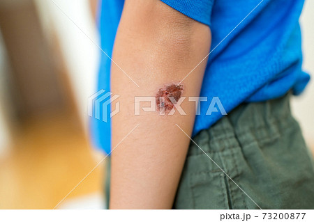 7 years old 73200877