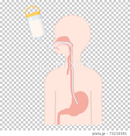 経鼻経管栄養 Ngの管のイラスト 体の断面のイラスト素材