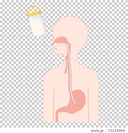 経管栄養_OGの管のイラスト_体の断面 73218469