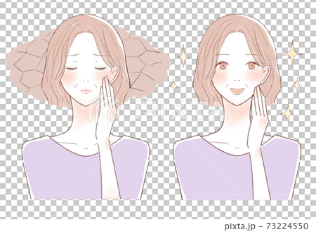 Before and after of middle-aged women suffering from dry skin 73224550