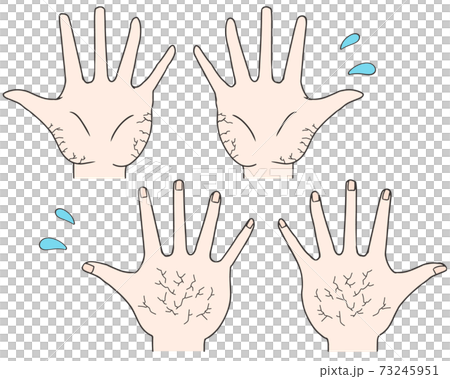 Hand cracked white - Stock Illustration [73245951] - PIXTA
