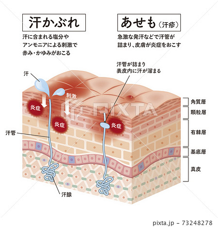 Cross section of the skin 31re 73248278