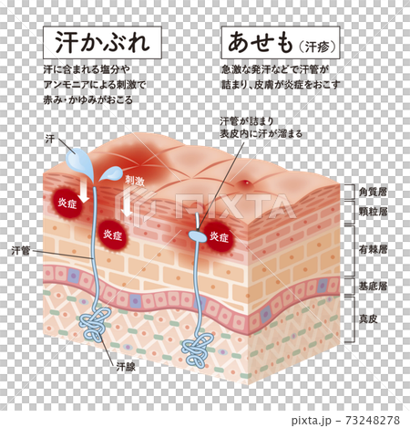 Cross section of the skin 31re 73248278